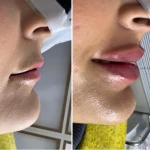 نمونه کار کلینیک پوست مو زیبایی و لیزر سارا
