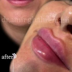 نمونه کار کلینیک تخصصی پوست مو وزیبایی دریا