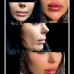 مرکز کلینیک لیزر زیبایی پوست و مو آسا