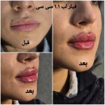کلینیک زیبایی و لیزر مو گندم