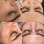  خدمات تخصصی پاکسازی پوست ساجده عنایتی