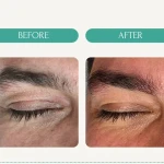پاکسازی پوست(فیشال) و خدمات مو مرجان آرا