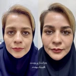 کلینیک تخصصی پوست و زیبایی بهشاد