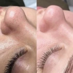 فیشال تخصصی و درمانی میسون