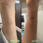 مرکز لیزرو کلینیک زیبایی طراوت