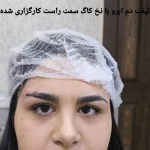 کلینیک زیبایی و لیزر مو گندم