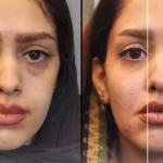  کلینیک لیزر پوست و مو زیبایی توکا