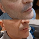 مطب پوست ،مو زیبایی دکتر فاطمه قره داغی