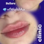مرکز لیزر کلینیک زیبایی رزنیلای مرزداران