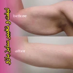 نمونه کار مرکز زیبایی، لیزر و تناسب اندام لبخند