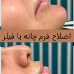 کلینیک پوست مو لیزر لاغری زیباریس