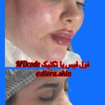 کلینیک زیبایی و مرکز لیزر و هایفو مرکز دلورا