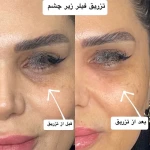 کلینیک لیزر و زیبایی پرین
