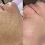 تصویر فیشال تخصصی و درمانی میسون