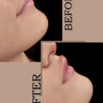 کلینیک زیبایی درناز (تخفیف ویژه لیزر)