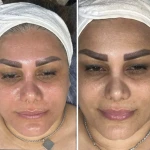 کلینیک تخصصی پوست و مو بهاره محمدحسینی