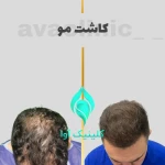 نمونه کار کلینیک تخصصی پوست و کاشت مو آوا