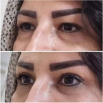 جراحی  زیبایی بینی  و صورت نئوفیس