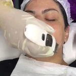  پاکسازی پوست آزیتا (هدیه مراجعه اول🎁)