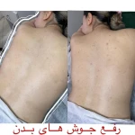 مرکز لیزرو پوست و طب سوزنی الماس تابان