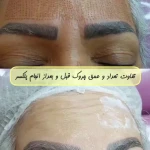 نمونه کار کلینیک زیبایی لاوین شرق