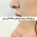نمونه کار مرکز لیزر و زیبایی دمور