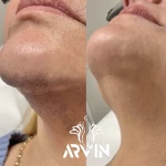 کلینیک زیبایی آروین