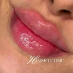 کلینیک زیبایی حانیمو