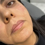 کلینیک زیبایی  و لاغری تخصصی میرای