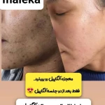  فشیال پاکسازی تخصصی ملکیا سلیمی