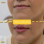 تصویر کلینیک زیبایی و لیزر الماس