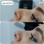 کلینیک پوست مو زیبایی و لیزر نیل