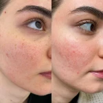 مرکز لیزر کلینیک زیبایی دنیای نقره ای