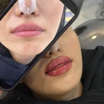 کلینیک پوست و مو لیزر و زیبایی ناریتا