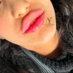 کلینیک زیبایی دکتر یوسف زادگان