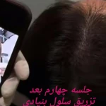 نمونه کار کلنیک زیبایی و لیزر نایس