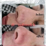 نمونه کار مرکز زیبایی و لیزر دکتر مریم نوکنده