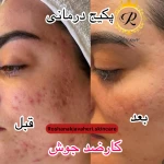  آموزشگاه وخدمات پاکسازی پوست جواهری