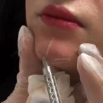 تصویر مطب پوست ،مو،زیبایی(دکتر سمیرا گرجی)