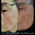 کلینیک زیبایی مرکز لیزر دکترپروانه نوری