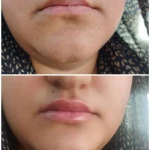 کلینیک تخصصی لیزر نوران