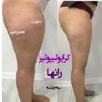 كلينيك زيبايي و ليزر بيوتا (شعبه رسالت)