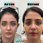 کلینیک زیبایی ژاله