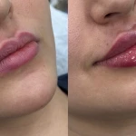 کلینیک زیبایی و لیزر سپیداسکین در تهران