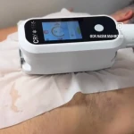 لیزر،پوست،مو(منطقه ۷ تهران)دکتر محمودی