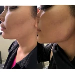  مرکز لیزرو پوست و طب سوزنی الماس تابان