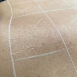 تصویر کلینیک پوست،مو و لیزر موهای زائد نیوانتا