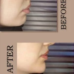 کلینیک زیبایی درناز (تخفیف ویژه لیزر)