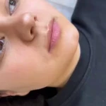  کلینیک زیبایی و مرکز لیزر سنسیا