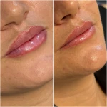 کلینیک لیزر و زیبایی دالیا